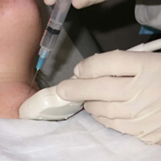 US GUTD Fine Needle Aspiration Cytology Test